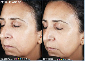 SkinMedica- HA5 Rejuvenating Hydrator-The Skin Spot