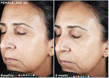 Before and after of SkinMedica HA5 Rejuvenating Hydrator showing improved hydration and skin smoothness after 8 weeks of use