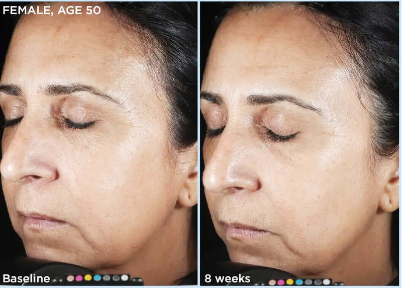 SkinMedica- HA5 Rejuvenating Hydrator-The Skin Spot