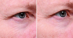 SkinMedica Instant Bright Eye Cream before and after image showing smoother under-eye skin with less visible puffiness