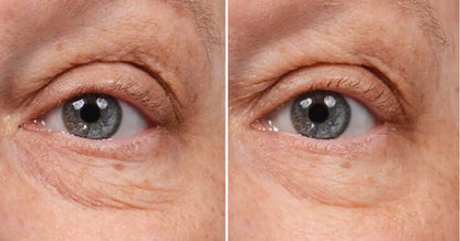 SkinMedica Instant Bright Eye Mask before and after image showing smoother under-eye lines with refreshed brighter eye area.