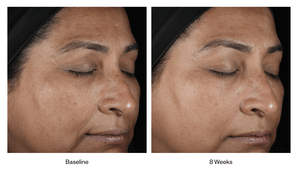 SkinMedica- LUMIVIVE System-The Skin Spot