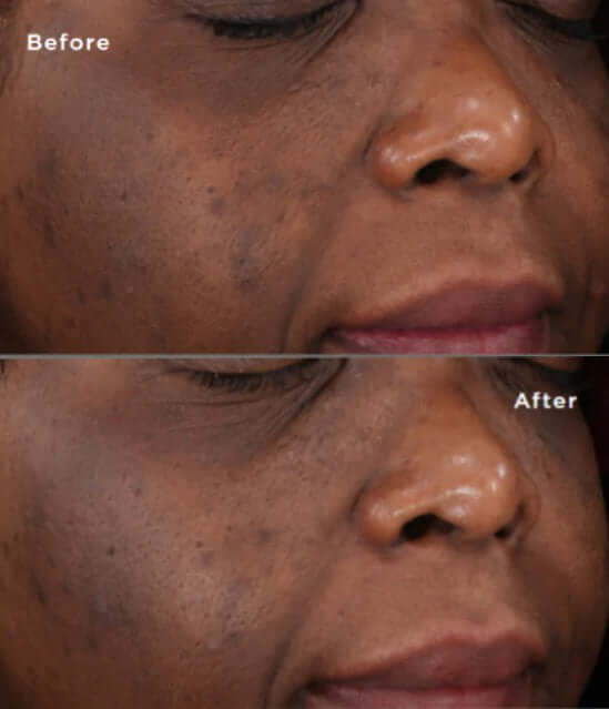 SkinMedica- Lytera 2.0 Pigment Correcting Serum-The Skin Spot