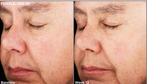 SkinMedica- Retinol Complex 0.5-The Skin Spot