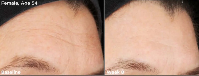 SkinMedica- Retinol Complex 0.5-The Skin Spot