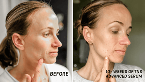 SkinMedica- TNS Advanced+ Serum-The Skin Spot