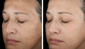 SkinMedica- TNS Recovery Complex-The Skin Spot