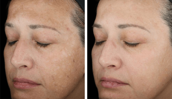 SkinMedica- TNS Recovery Complex-The Skin Spot