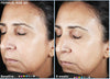 skinmedica ha5 rejuvenating hydrator before and after