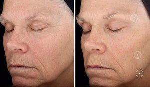 skinmedica tns recovery complex before and aftere