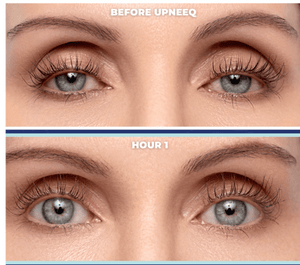 UPNEEQ® (Eye Opening Drops)-The Skin Spot