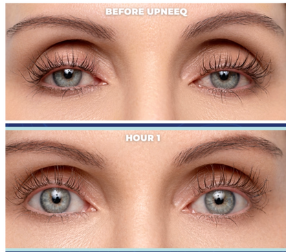 Before and after of UPNEEQ Eye Opening Drops showing lifted eyelids and more open eyes at hour 1 after application