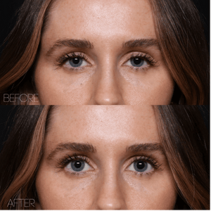 UPNEEQ® (Eye Opening Drops)-The Skin Spot